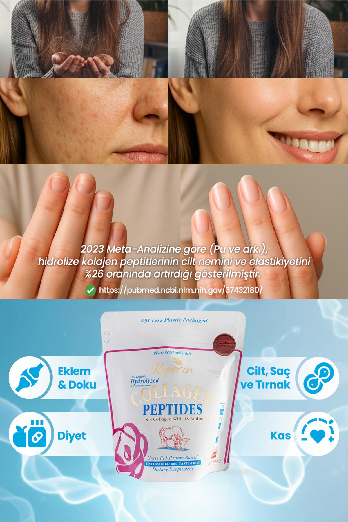 Kiperin Double Hydrolyzed Collagen Peptides is a premium bovine collagen powder formulated with advanced double hydrolysis technology to provide highly bioactive, small-molecule collagen peptides.