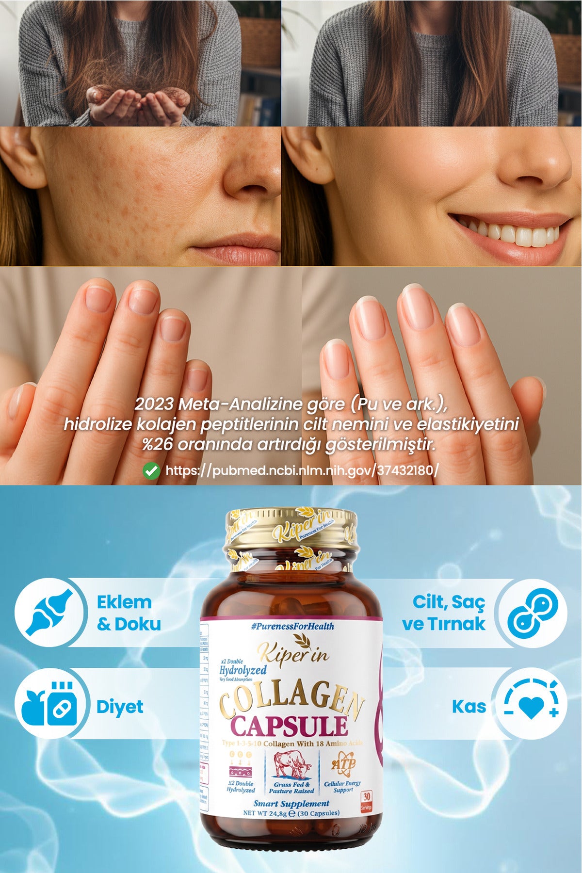 Kiperin Multi Collagen Complex is a comprehensive formula featuring Type I and Type III Hydrolyzed Bovine Collagen Peptides, combined with Hyaluronic Acid, ATP (Adenosine Triphosphate), Biotin (Vitamin B7), Vitamin C (Ascorbic Acid), Vitamin D3 (Cholecalc